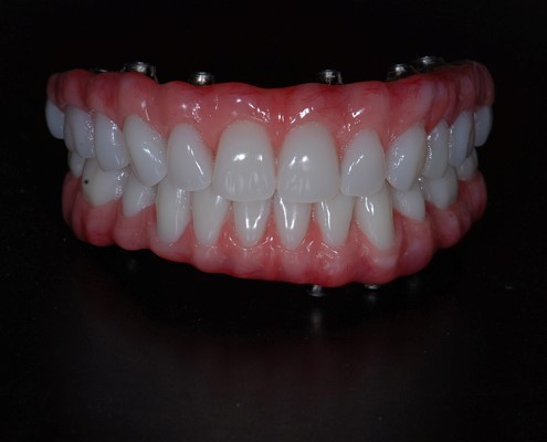 How To Clean Dentures Grantsburg WI 54840